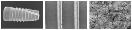 REM-Aufnahmen der CELLBIOTex®-Oberfläche (Korundgestrahlte, geätzte Oberfläche mit bioaktiver Calcium-Phosphat-Schicht)